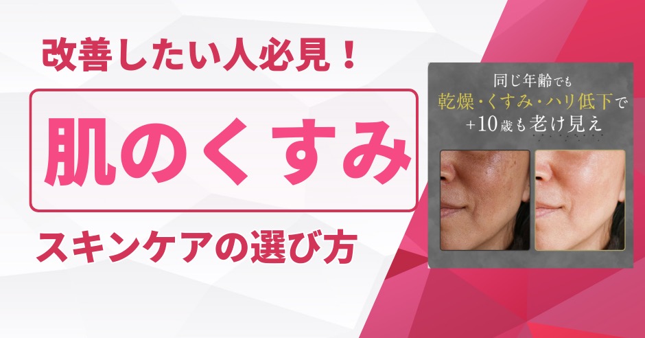 肌のくすみ改善したい人必見！市販スキンケアの選び方と本当に効く成分のアイキャッチ画像