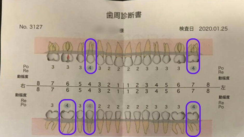 ジェットウォッシャーの使い方のコツの画像-2