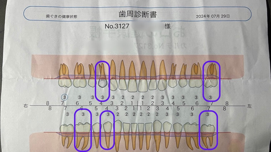 ジェットウォッシャーの使い方のコツの画像-3